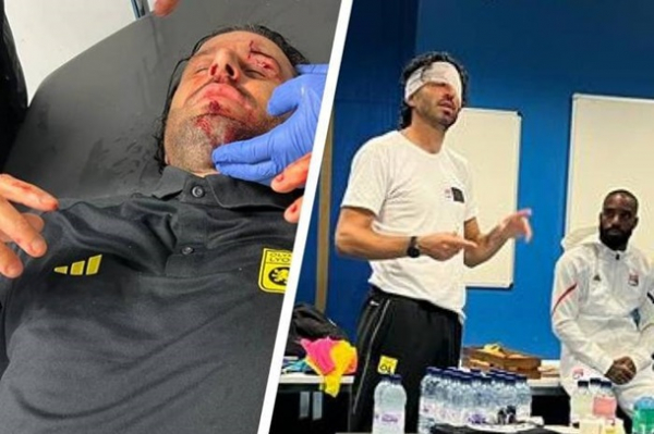 Агресивні фанати Марселя атакували автобус Ліона